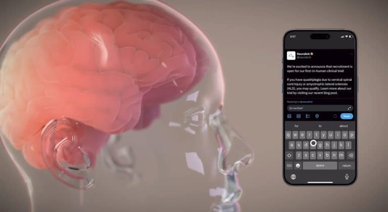 Neuralink’s Groundbreaking Implant: A New Dawn for Quadriplegia Patients